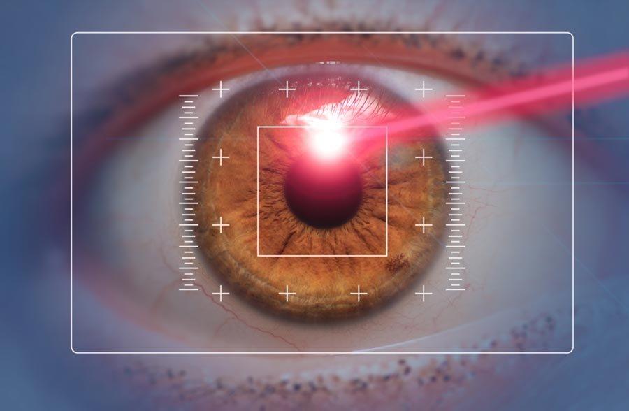 Close-up of a brown eye with digital targeting graphics and a red laser beam directed at the pupil, illustrating LASIK eye surgery or laser eye surgery for vision correction or advanced eye scanning procedures.