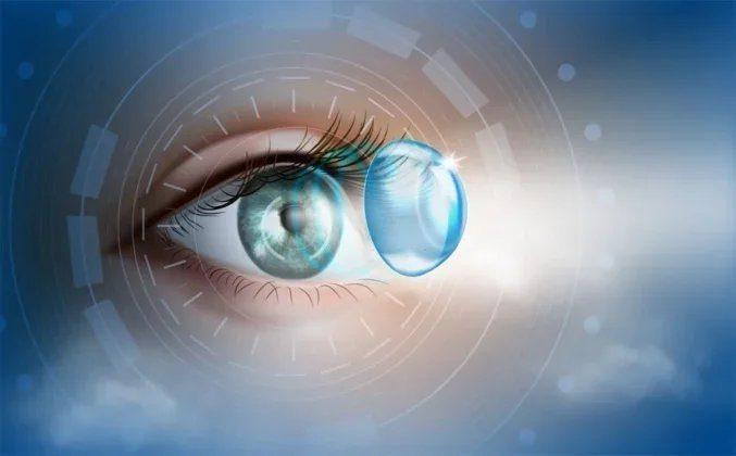 Illustration of an implantable collamer lens positioned inside the eye, behind the iris and in front of the natural lens.