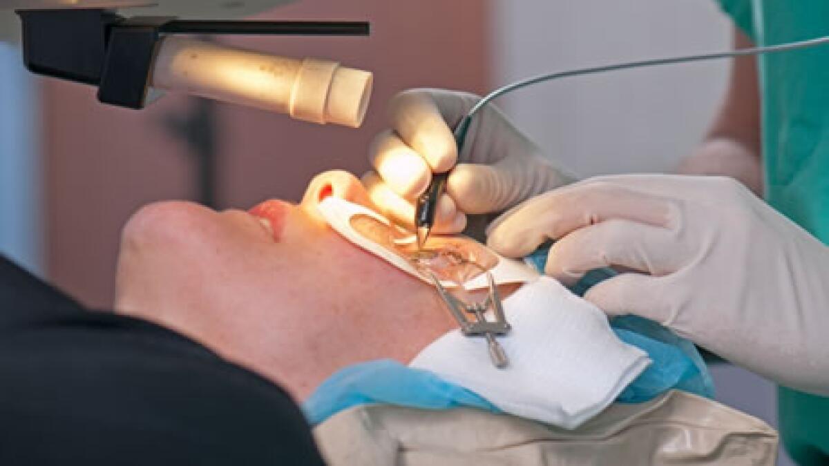 A person undergoing laser eye surgery for vision correction, with a bright light focused on their eye, which is held open with a speculum. A surgeon wearing gloves uses surgical instruments near the eye.