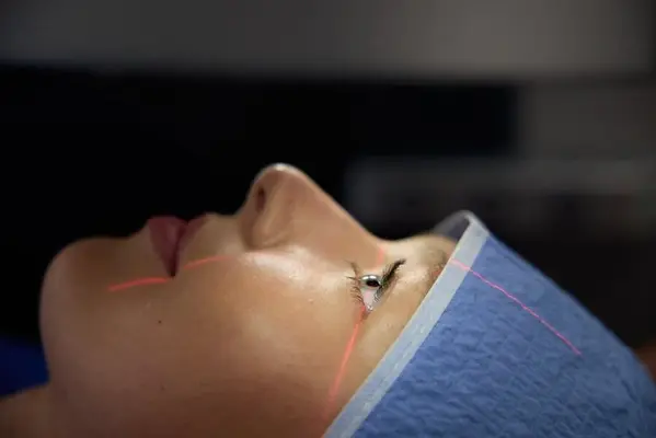 Featured image for The definitive guide to laser eye surgery
