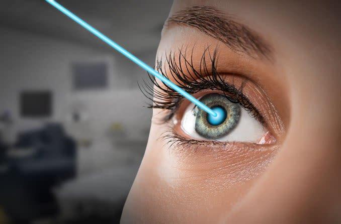 Close-up of a person’s eye with a blue laser beam targeting the cornea, illustrating LASIK eye surgery in a clinical setting and raising awareness about the ideal age for LASIK procedures.