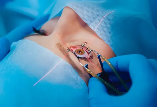 Featured image for LASIK Age Limit: What You Need to Know