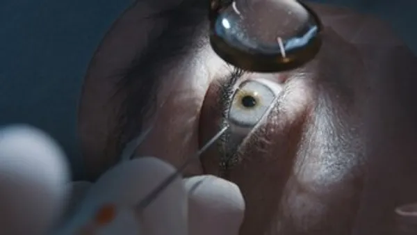 Featured image for How Long Does Cataract Eye Surgery Take? A Quick Guide